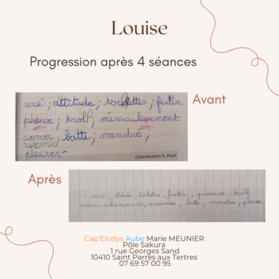 Un avant-après l'orthographothérapie près de Troyes.